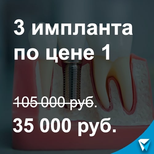 3 импланта по цене 1